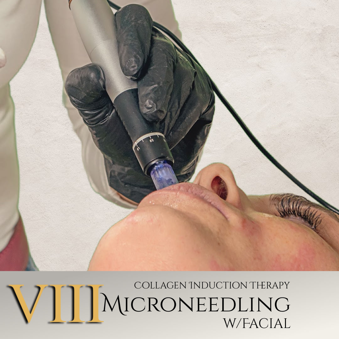 Microneedling (8 sessions, 1 yr. value) at Tucson